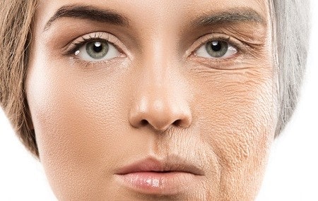 کُلاژن سازی پوست چگونه است ؟