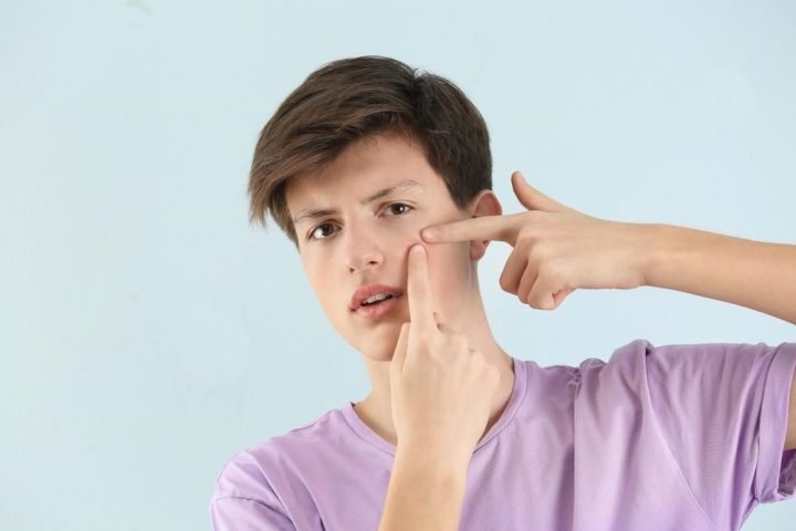 جوش صورت و تمام نکاتی که باید برای درمان و جلوگیری از آن بدانید!